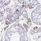 Immunohistochemical staining of human testis shows moderate cytoplasmic positivity in Leydig cells.