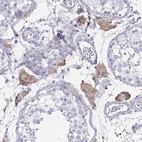 Immunohistochemical staining of human testis shows moderate cytoplasmic positivity in Leydig cells.
