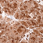 Immunohistochemical staining of human pancreas shows strong membranous positivity in exocrine glandular cells.