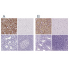 Immunohistochemical staining of human adrenal gland, cerebral cortex, endometrium and tonsil using Anti-FDX1 antibody HPA062087 (A) shows similar protein distribution across tissues to independent antibody HPA041630 (B).