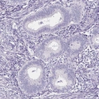 Immunohistochemical staining of human endometrium shows no positivity in glandular cells as expected.