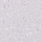 Immunohistochemical staining of human cerebral cortex shows no positivity in neuronal cells as expected.
