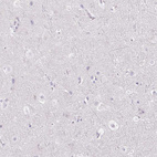 Anti-FDX1 Antibody