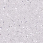 Immunohistochemical staining of human cerebral cortex shows no positivity in neuronal cells as expected.