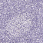 Immunohistochemical staining of human tonsil shows no positivity in germinal center cells as expected.