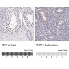 Anti-TEPP Antibody