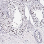Immunohistochemical staining of human testis shows high expression.