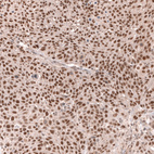 Anti-MSH3 Antibody