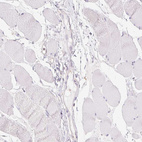 Anti-TMEM45A Antibody