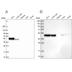 Western blot analysis using Anti-RCN1 antibody HPA062104 (A) shows similar pattern to independent antibody HPA038474 (B).
