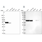 Western blot analysis using Anti-RCN1 antibody HPA062104 (A) shows similar pattern to independent antibody HPA038474 (B).
