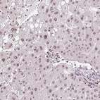 Anti-RNF181 Antibody