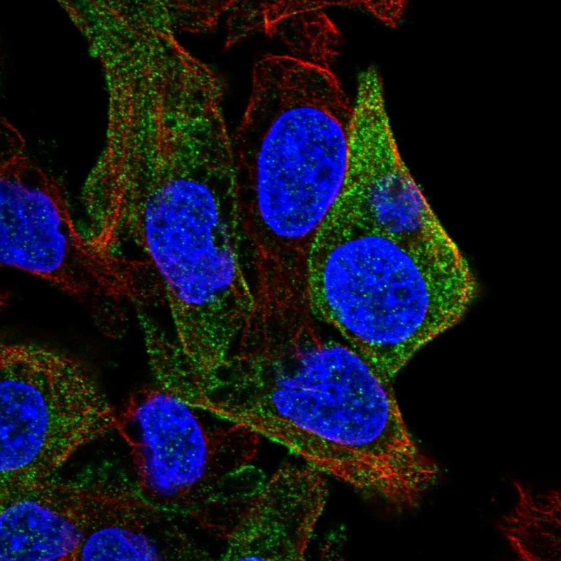 Anti-SDPR Antibody