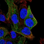 Anti-SDPR Antibody
