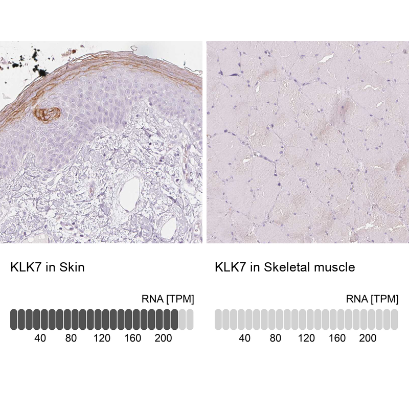 Anti-KLK7 Antibody