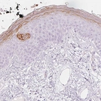 Immunohistochemical staining of human skin shows weak to moderate cytoplasmic positivity in keratinocytes.