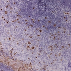 Immunohistochemical staining of human tonsil shows moderate to strong cytoplasmic positivity in granulocytes.