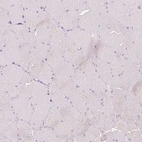 Immunohistochemical staining of human skeletal muscle shows no positivity in myocytes as expected.
