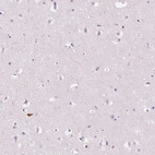 Immunohistochemical staining of human cerebral cortex shows no positivity in neurons as expected.