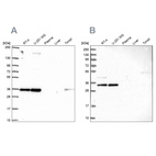 Anti-NOSIP Antibody