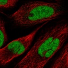 Immunofluorescent staining of human cell line U-2 OS shows localization to nucleus.