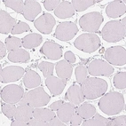 Immunohistochemical staining of human skeletal muscle shows low expression as expected.