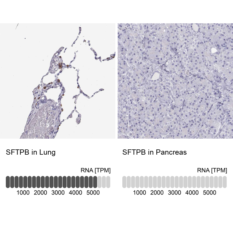 Anti-SFTPB Antibody