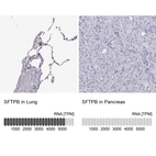 Anti-SFTPB Antibody