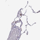 Anti-SFTPB Antibody