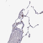 Immunohistochemical staining of human lung shows moderate cytoplasmic positivity in macrophages.