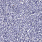 Anti-SFTPB Antibody