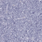 Immunohistochemical staining of human tonsil shows negative cytoplasmic positivity in non-germinal center cells as expected.