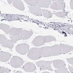 Anti-SFTPB Antibody