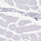 Immunohistochemical staining of human skeletal muscle shows negative cytoplasmic positivity in myocytes as expected.