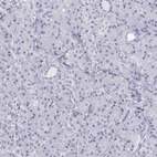 Immunohistochemical staining of human pancreas shows negative cytoplasmic positivity in exocrine glandular cells as expected.