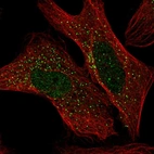 Anti-ADAM32 Antibody