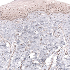 Immunohistochemical staining of human cervix, uterine shows moderate nuclear positivity in squamous epithelial cells.