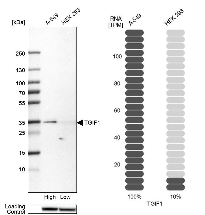 Anti-TGIF1 Antibody