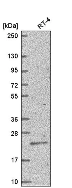 Western blot analysis in human cell line RT-4.