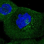 Immunofluorescent staining of human cell line A-431 shows localization to plasma membrane & vesicles.