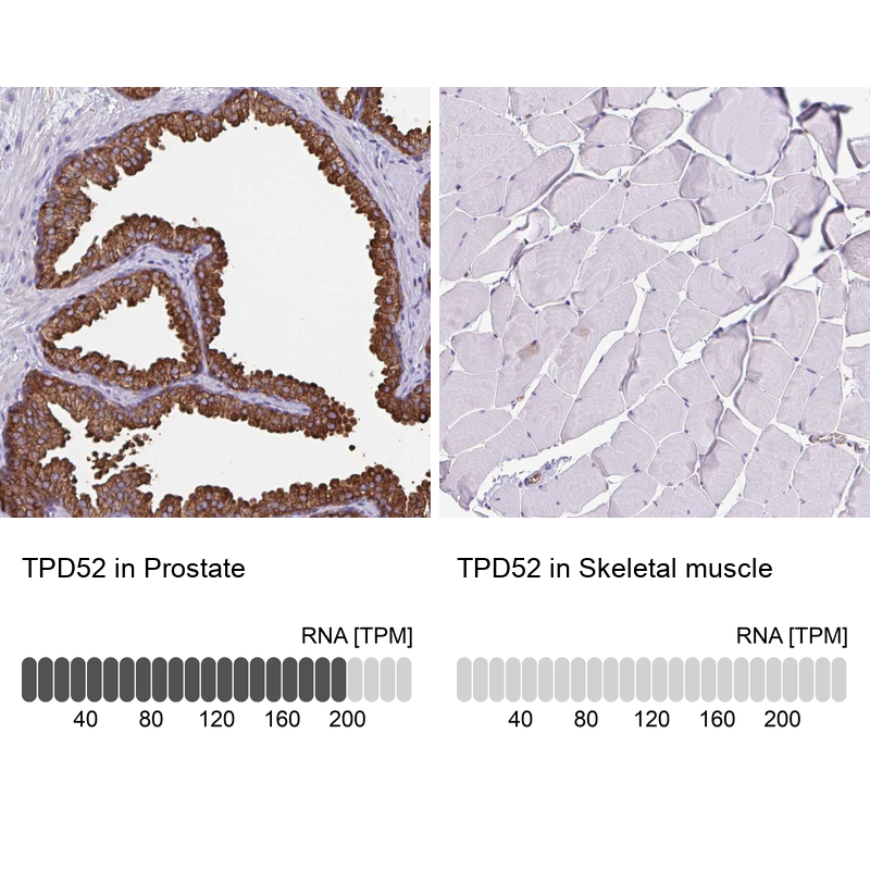 Anti-TPD52 Antibody