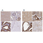 Immunohistochemical staining of human cerebral cortex, kidney, prostate and skeletal muscle using Anti-TPD52 antibody HPA062167 (A) shows similar protein distribution across tissues to independent antibody HPA028427 (B).