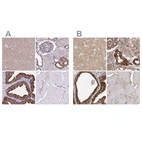 Immunohistochemical staining of human cerebral cortex, kidney, prostate and skeletal muscle using Anti-TPD52 antibody HPA062167 (A) shows similar protein distribution across tissues to independent antibody HPA028427 (B).