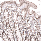 Immunohistochemical staining of human colon shows moderate nuclear positivity in glandular and lymphoid cells.