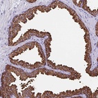 Anti-TPD52 Antibody