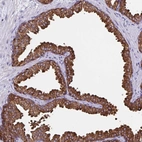Immunohistochemical staining of human prostate shows high expression.