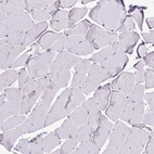 Immunohistochemical staining of human skeletal muscle shows low expression as expected.