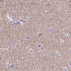 Immunohistochemical staining of human cerebral cortex using Anti-TPD52 antibody HPA062167.