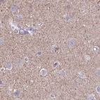 Anti-TPD52 Antibody