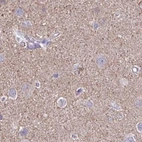 Immunohistochemical staining of human cerebral cortex using Anti-TPD52 antibody HPA062167.